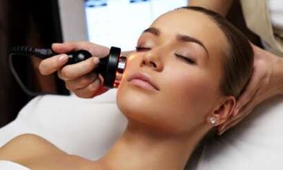 Laser para melasma
