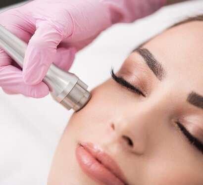 Peeling de diamante
